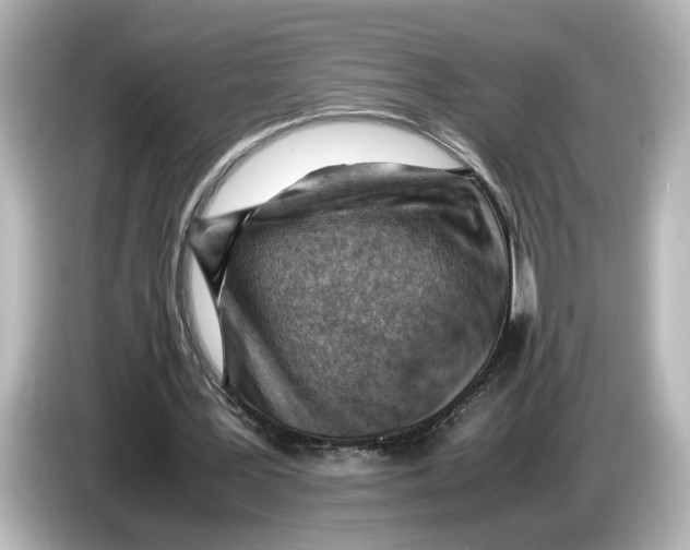 X0000085750387200704091320