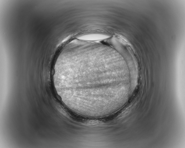 X0000085750399200704091320