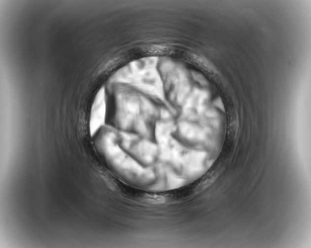 X0000085750469200704091319