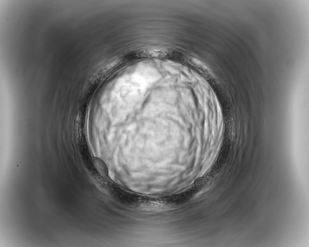 X0000085750594200704091317