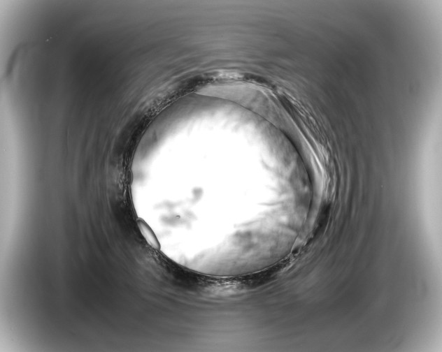 X0000085750609200704091317