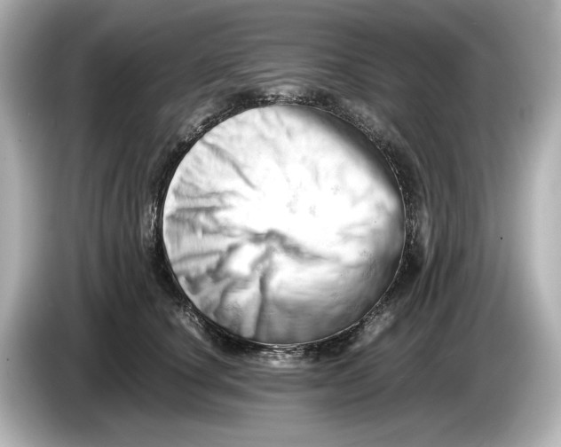 X0000085750660200704091317