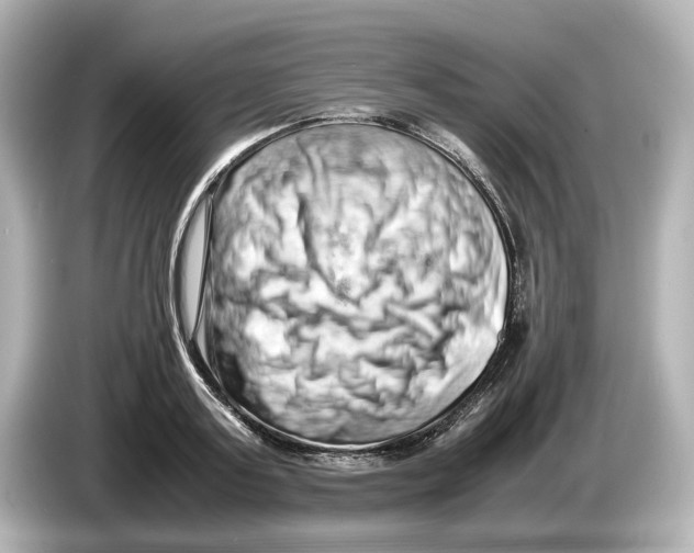 X0000085750795200704091315