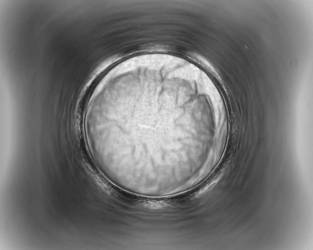 X0000085750835200704091314