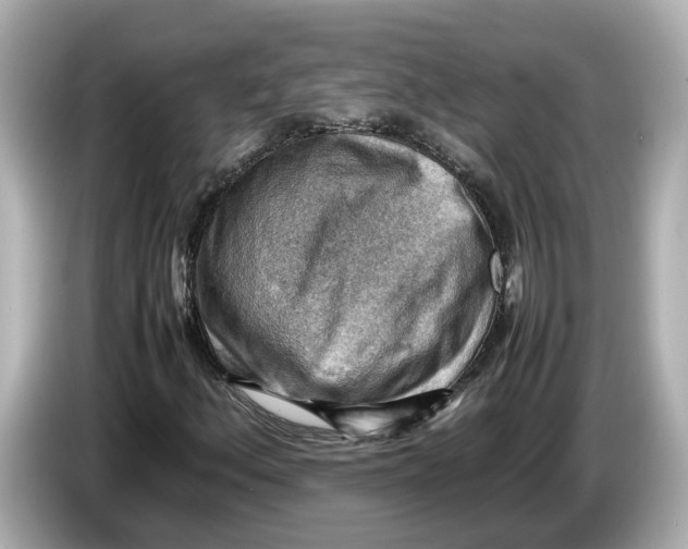 X0000085751156200704091311