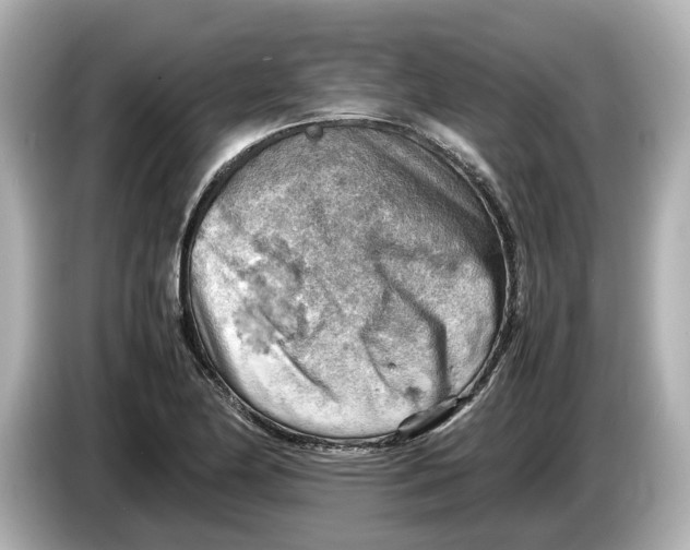 X0000085751174200704091310