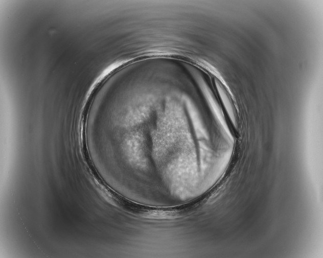 X0000085751179200704091310