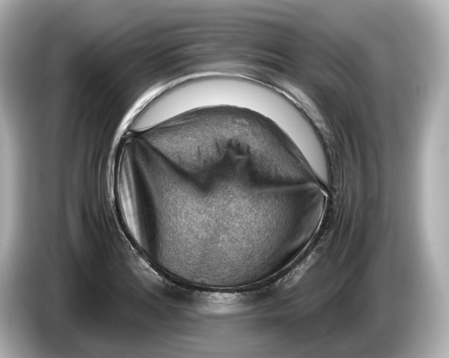 X0000085751180200704091310