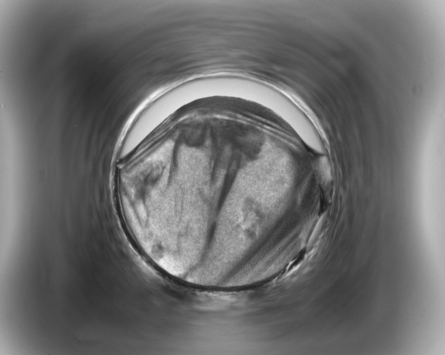 X0000085751197200704091310