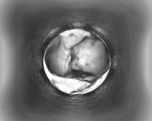 X0000085751205200704091310