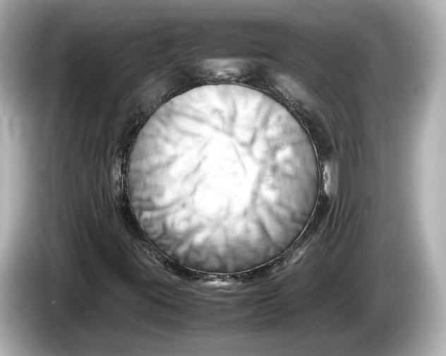 X0000085751395200704091307