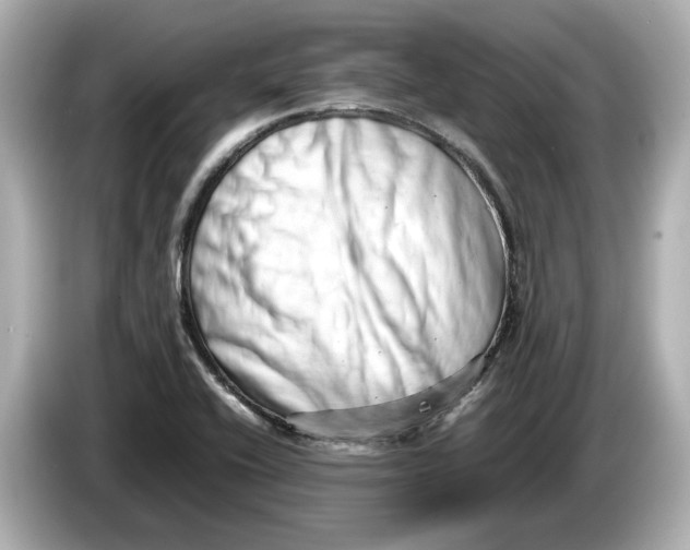 X0000085751416200704091308