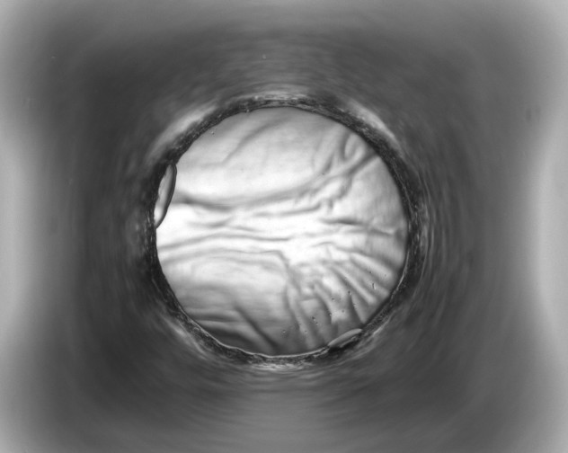 X0000085751448200704091307