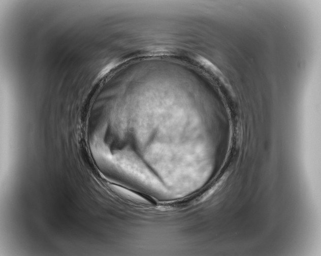 X0000085751449200704091307