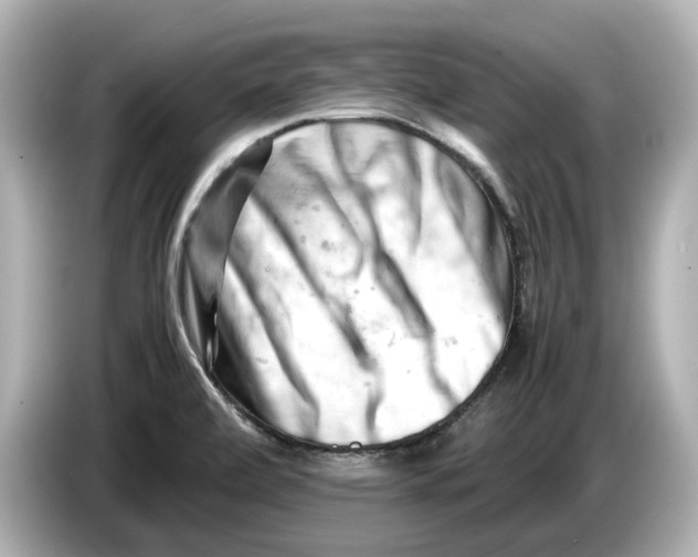 X0000085751472200704091307