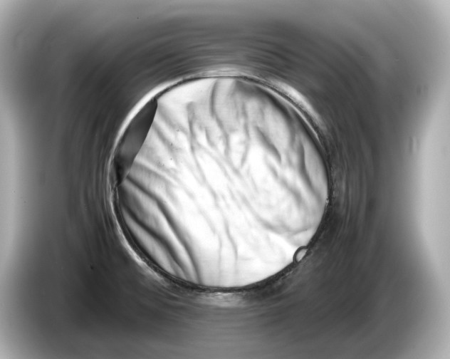 X0000085751476200704091307