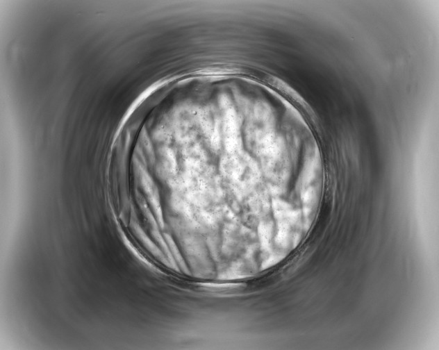 X0000085751487200704091307