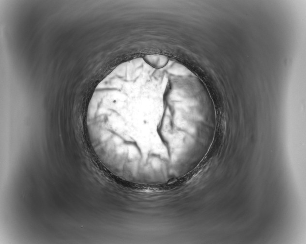 X0000085751489200704091306