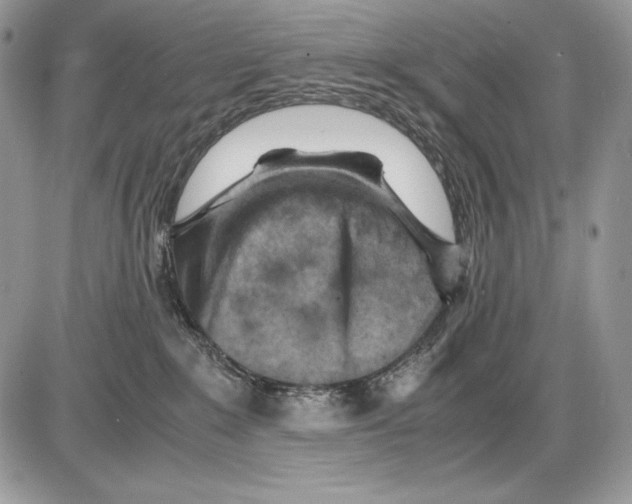 X0000085750235200704131720