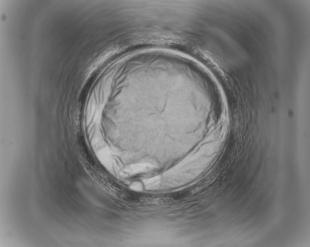 X0000085750679200704131712