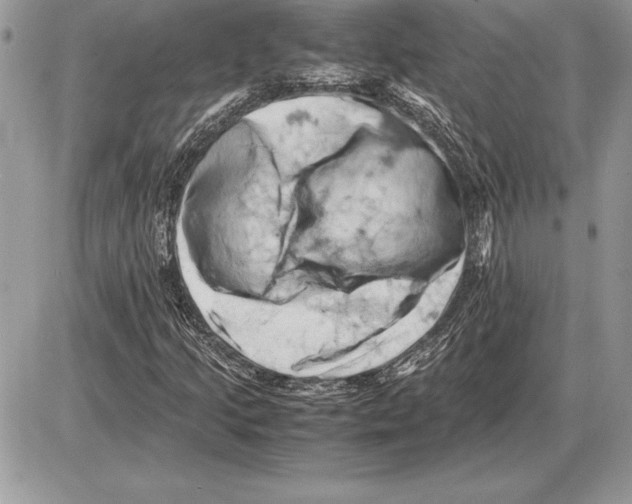 X0000085751205200704131702