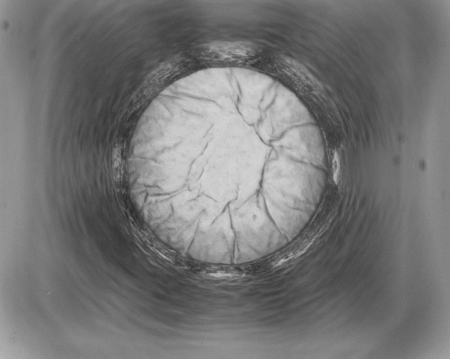 X0000085751395200704131658