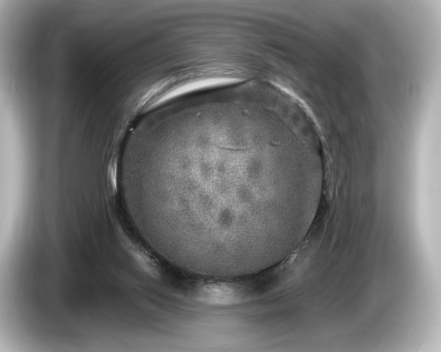 X0000085760062200703161128