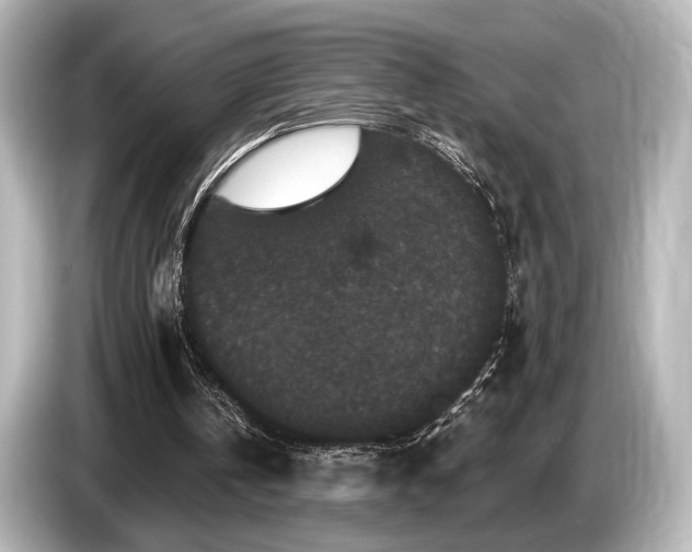 X0000085760146200703161126