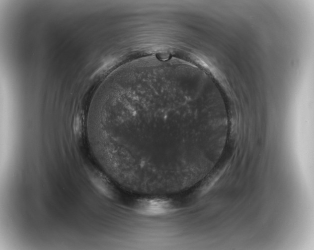 X0000085760165200703161127