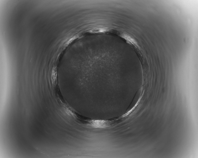 X0000085760192200703161127