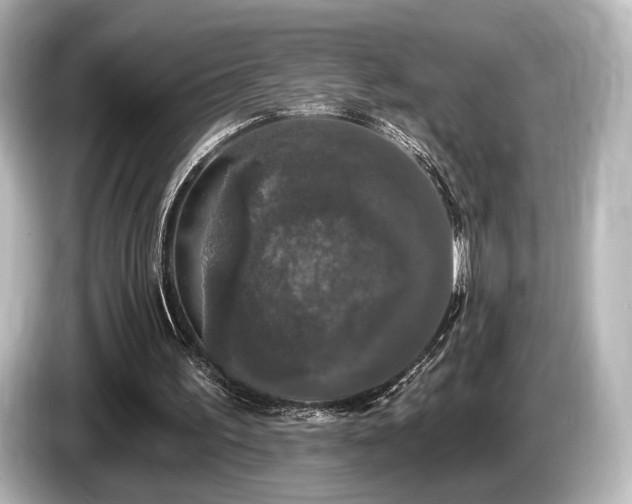 X0000085760195200703161126