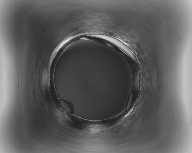 X0000085760200200703161126