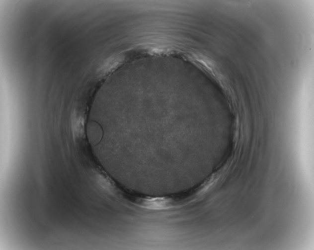 X0000085760269200703161125