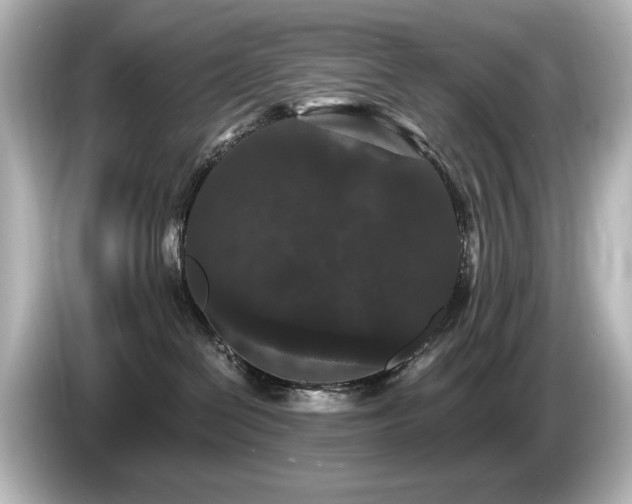 X0000085760286200703161125