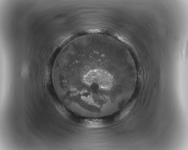 X0000085760359200703161123