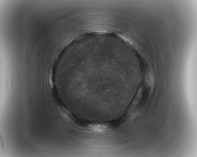 X0000085760512200703161121