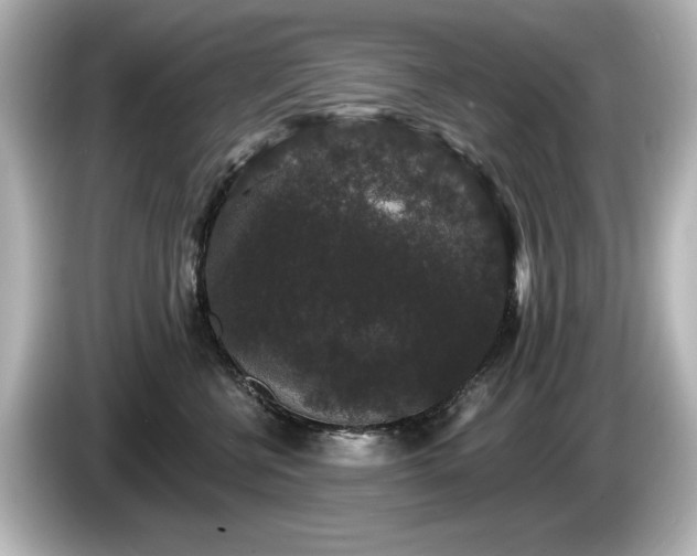 X0000085760570200703161120