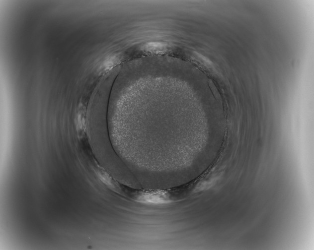 X0000085760576200703161121