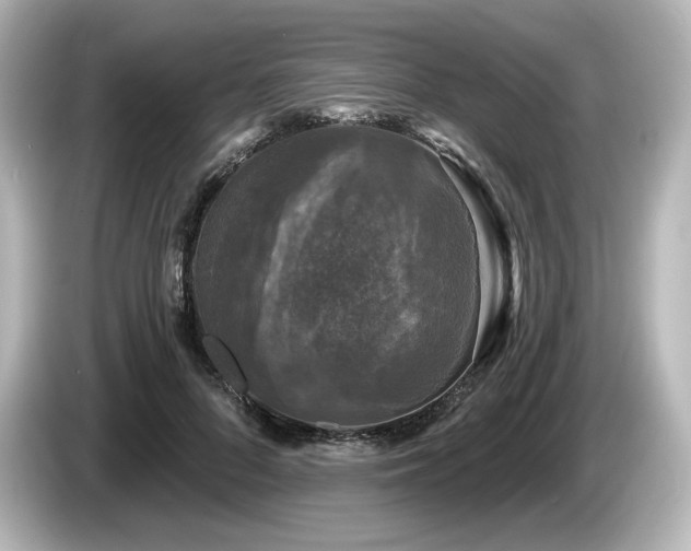 X0000085760696200703161118