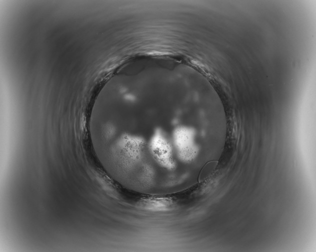 X0000085760711200703161118