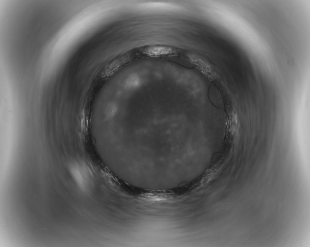 X0000085760763200703161118