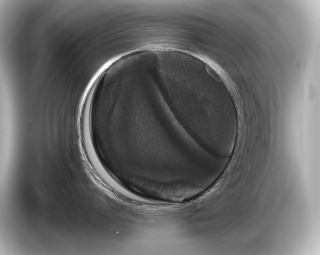 X0000085760864200703161116