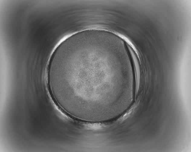 X0000085760999200703161114