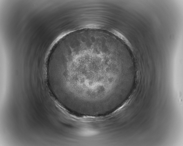 X0000085761027200703161113