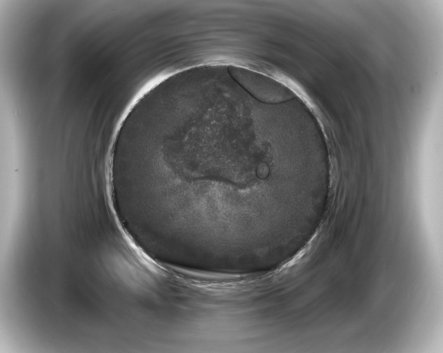 X0000085761048200703161113