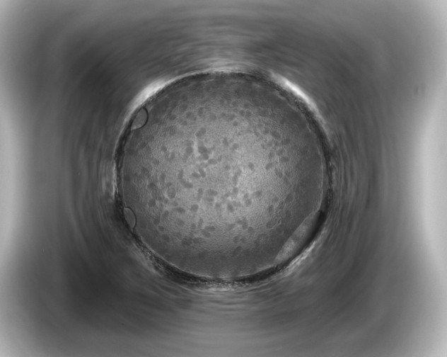 X0000085761267200703161110