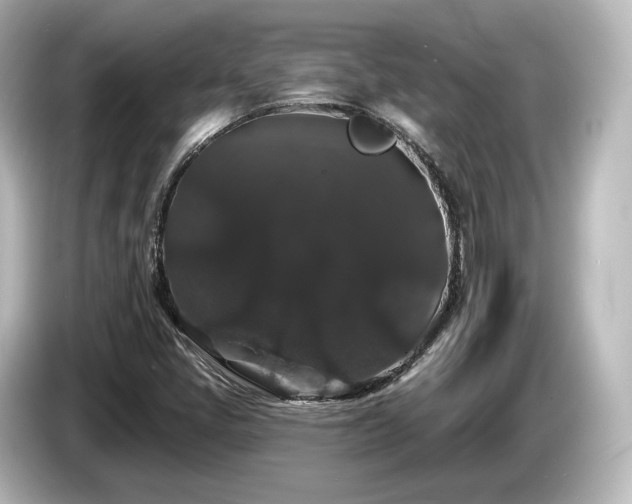 X0000085761405200703161107