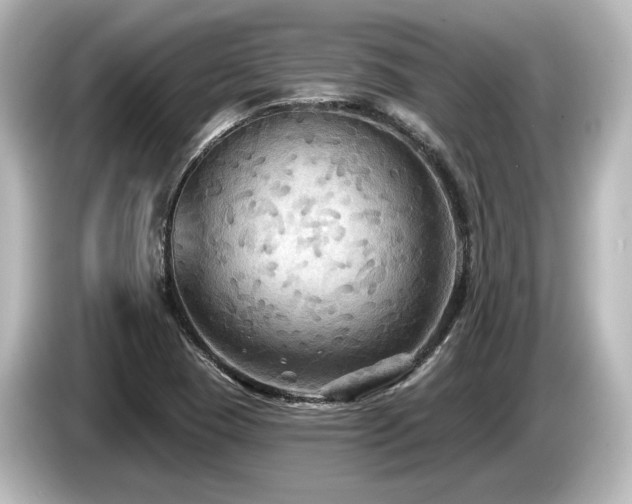 X0000085761409200703161107