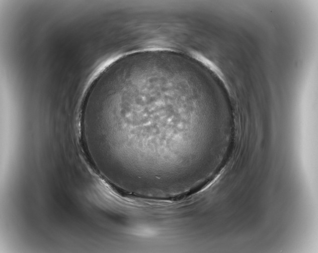 X0000085761415200703161107