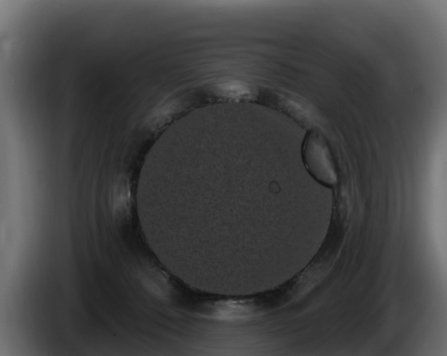 X0000085760320200703231200